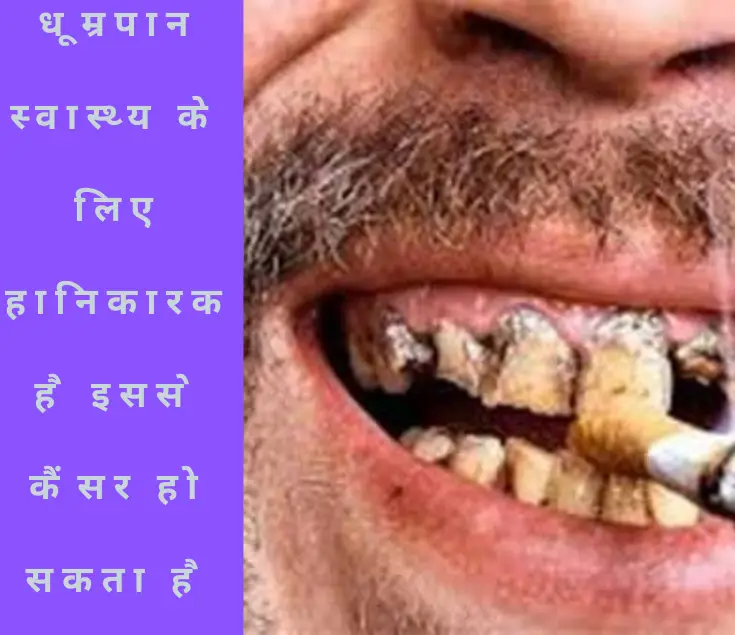 मुंह का कैंसर, लक्षण