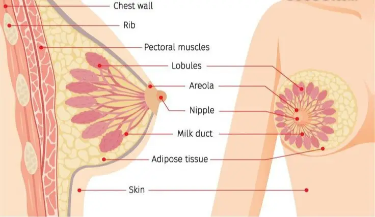 Breast/स्तन कैंसर cancer